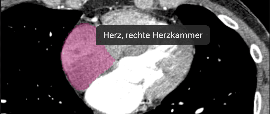 Automatische Identifikation von Organen auf medizinischen Bildern mit anatomischer Hervorhebung.