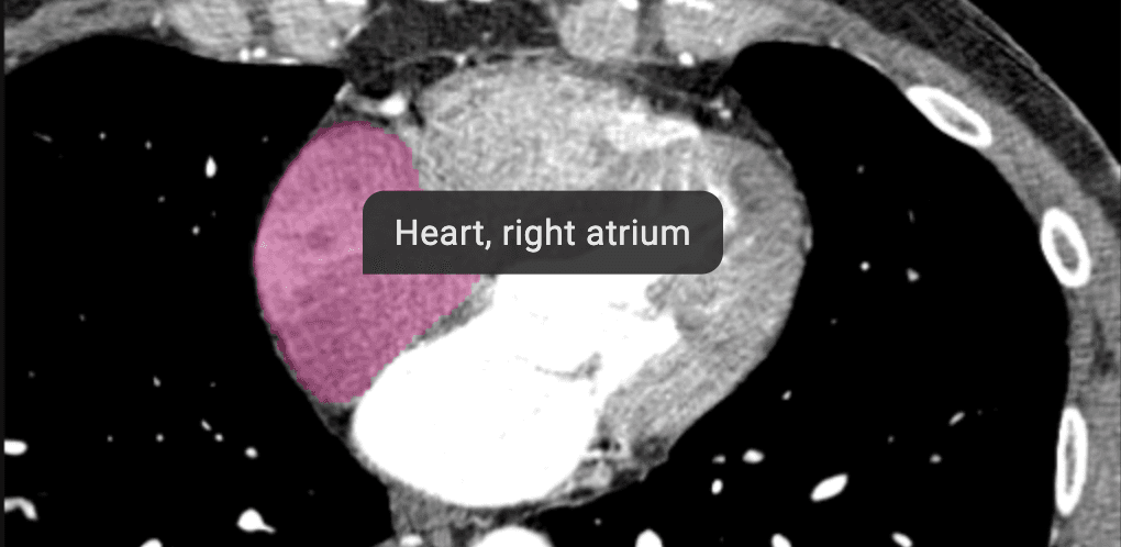 Automatic identification of organs on medical imaging with anatomical highlighting.