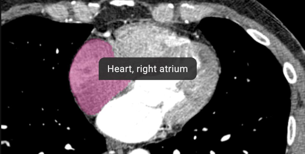 Automatic identification of organs on medical imaging with anatomical highlighting.