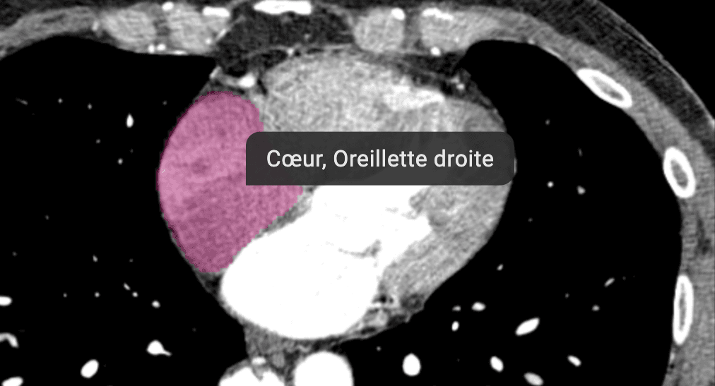 Identification automatique des organes sur une imagerie médicale avec surbrillance anatomique