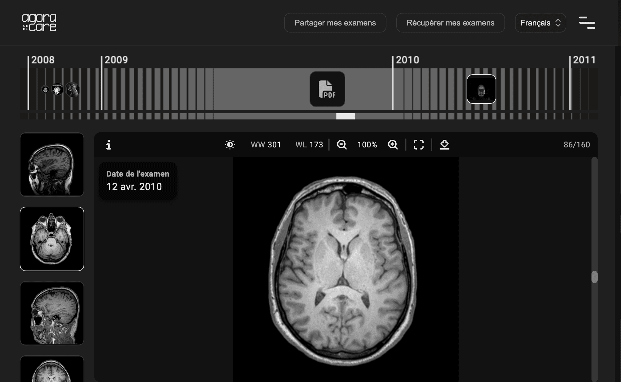 Vue chronologique des examens médicaux centralisés dans l’espace sécurisé Agora Care