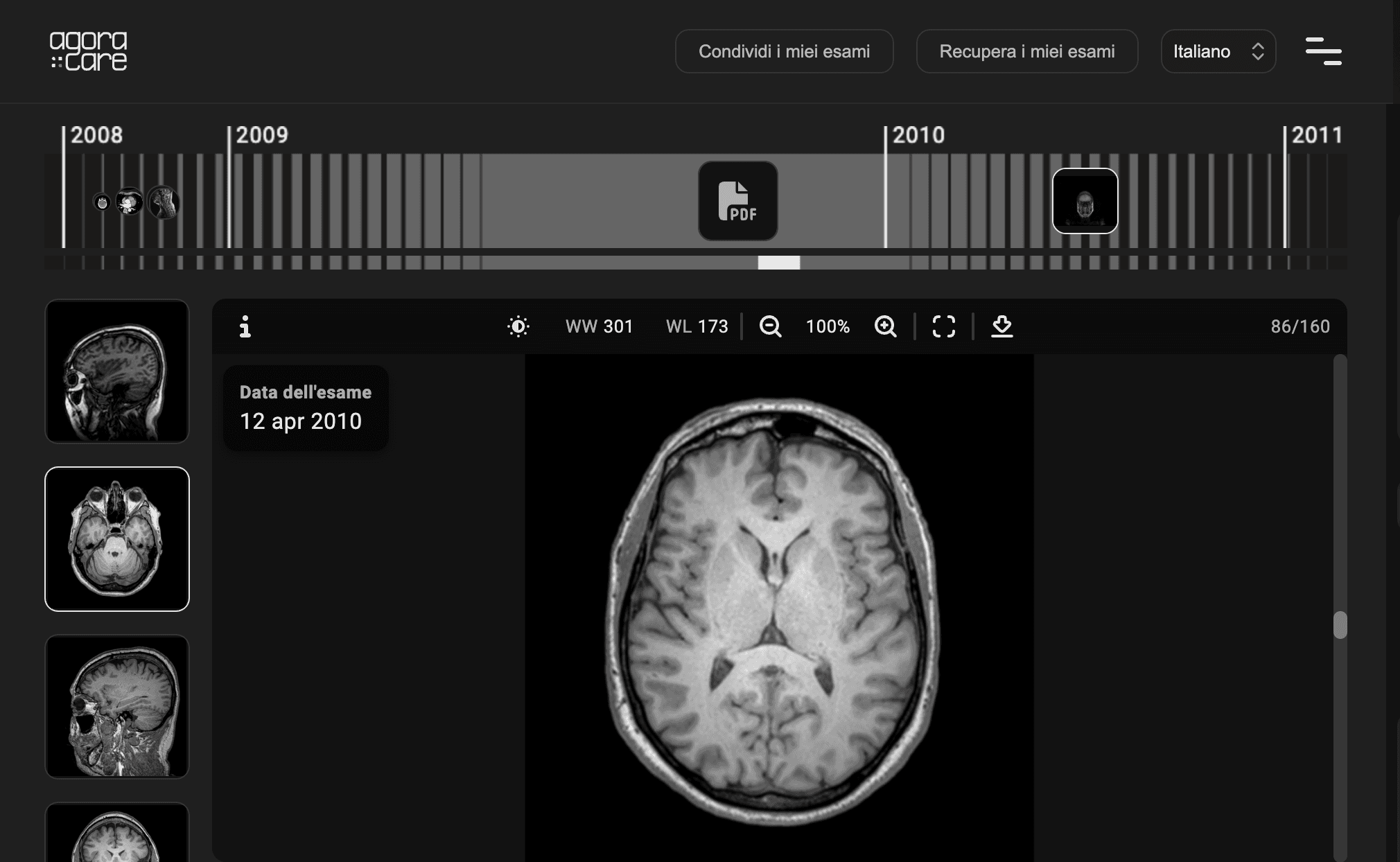 Vista cronologica degli esami medici centralizzati nello spazio sicuro di Agora Care.