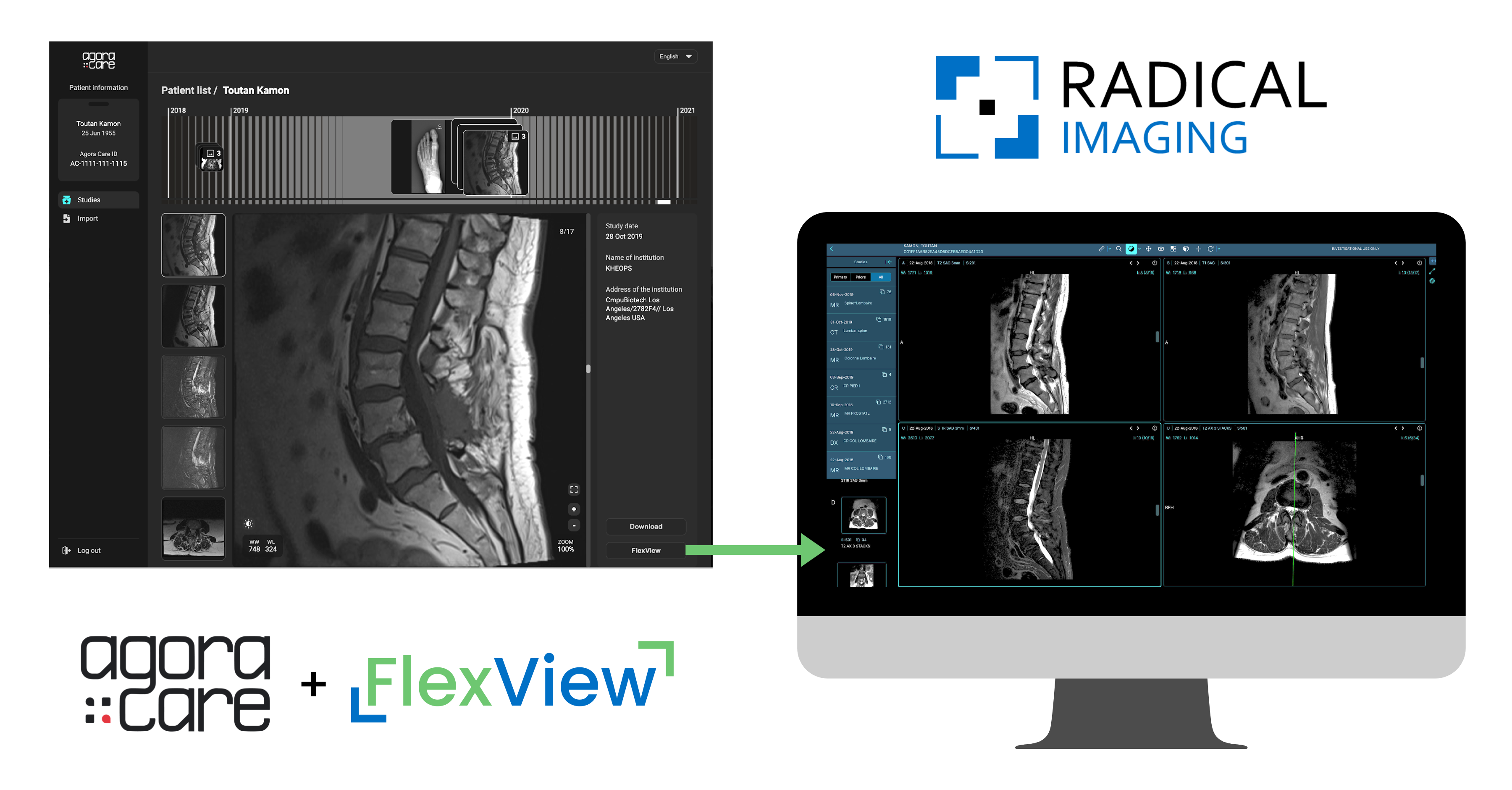 FlexView Inside Agora Care